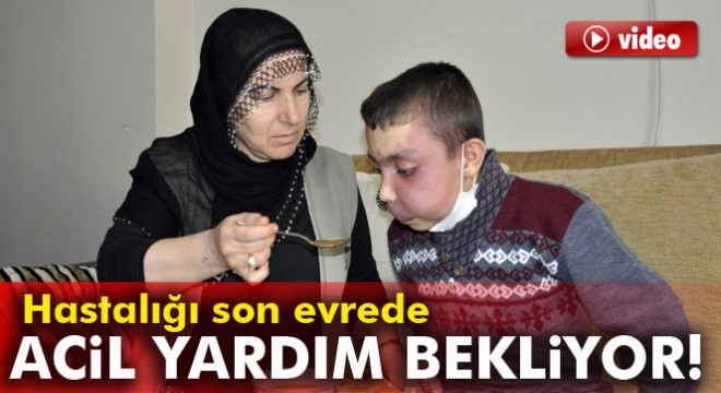 15 yaşındaki Sedat yardım bekliyor