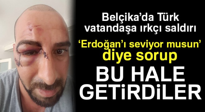 Belçika da ırkçılar Türk vatandaşını  Erdoğancı  diye darp etti